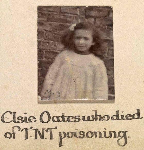 Photograph of Elsie Oates with wording underneath saying Elsie Oates who died of TNT poisoning